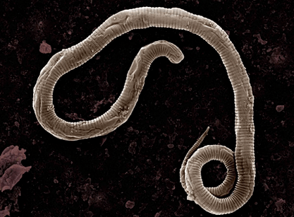Where the worms come from in the human body