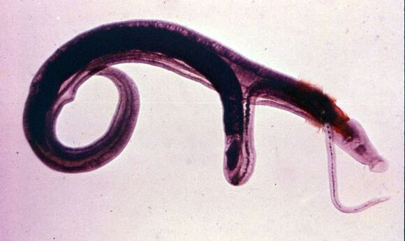 Schistosomes are one of the most common and dangerous parasites